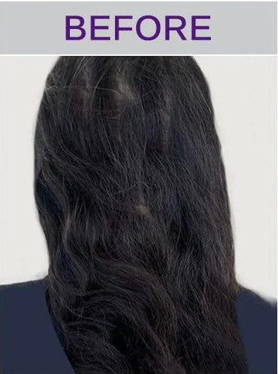 image comparison before