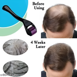 Derma Roller – Hair & Skin