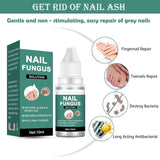 Nail Fungus Solution – 10ml