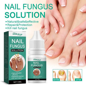 Nail Fungus Solution – 10ml