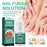 Nail Fungus Solution – 10ml